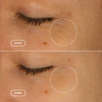 PhytoRétinol™ - Sérum Contour des Yeux