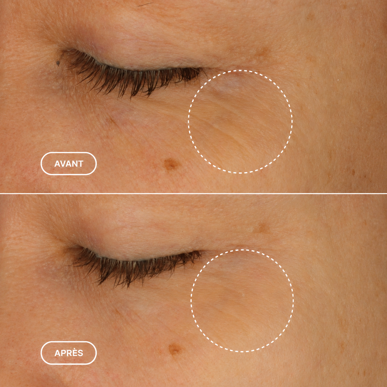 PhytoRétinol™ - Sérum Contour des Yeux